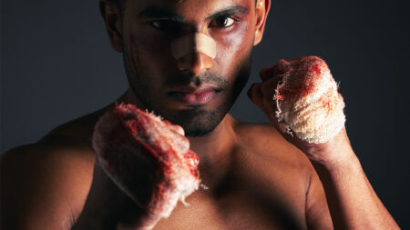 Boxing Hand Injuries