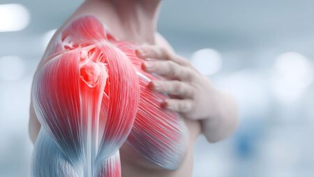 How to Prevent a Rotator Cuff Injury