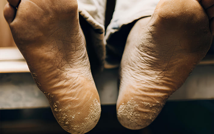 Chalk, Tape, or Mat Residue