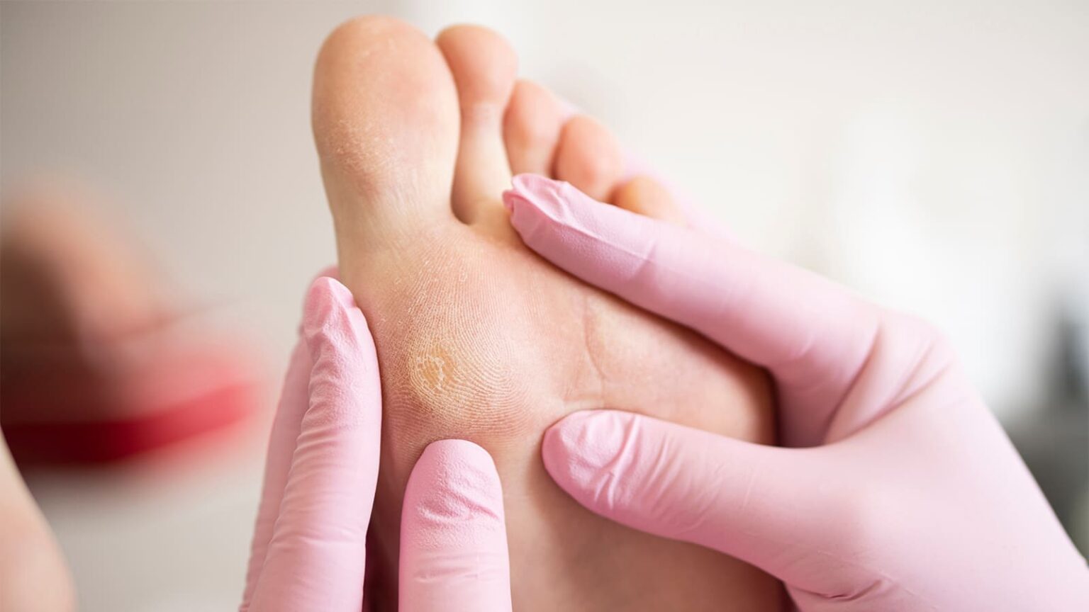 Why Are UFC Fighters’ Feet Yellow? 6 Possible Causes Why UFC Fighters have Yellow feet